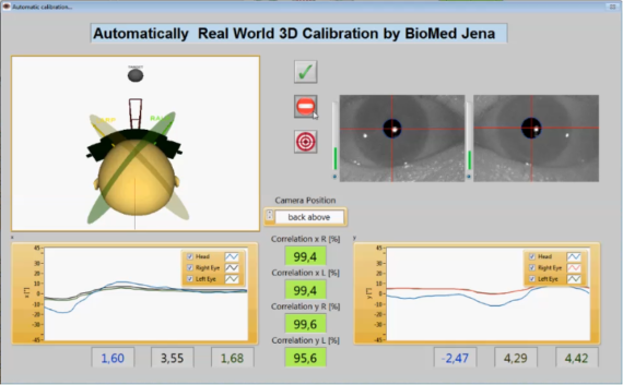 VNG nystagmografie test