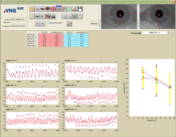 VNG nystagmografie test 3