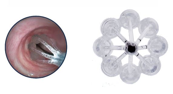 plaatje trachealator 2